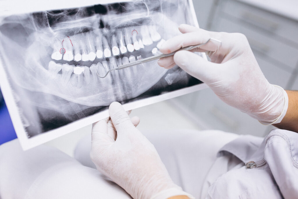 Radiografías realizadas en Clínica Dental Castilla para estudiar la dentadura de los pacientes