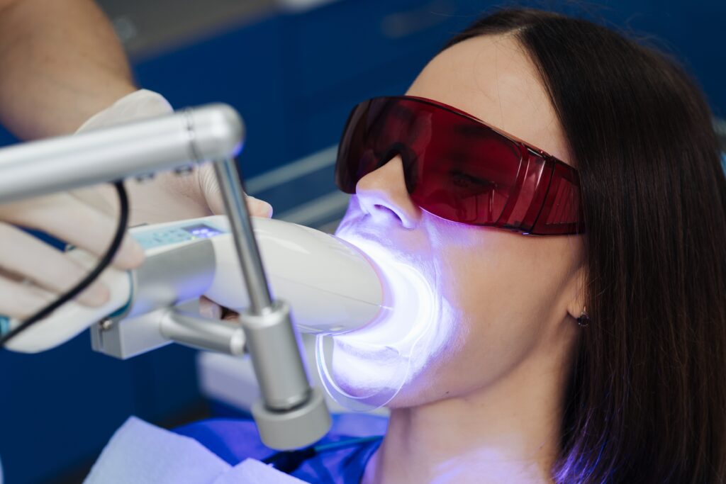 Tratamiento blanqueante con led en Clínica Dental Castilla 